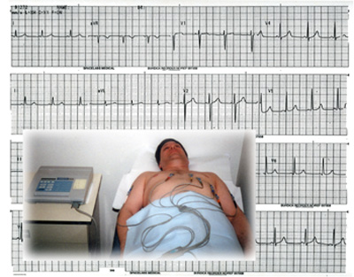 EKG Gerät